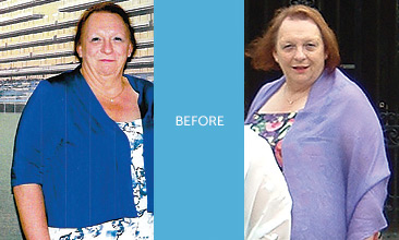 Weight loss