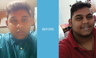 Weight loss